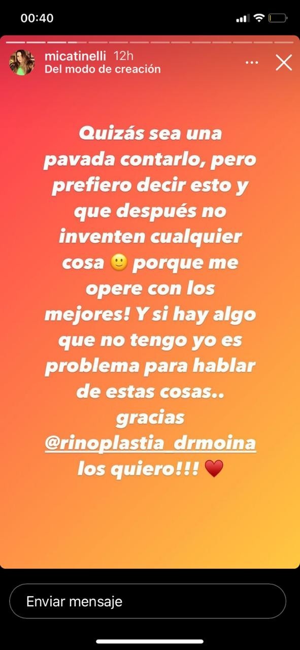 La explicación de Mica Tinelli tras su retoque estético.